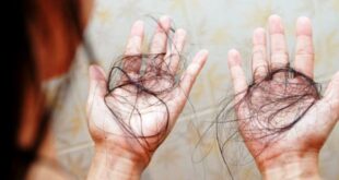 Cara Merawat Rambut Rontok dengan Menggunakan Bahan Alami